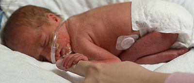 Neonatal Intensive Care Unit in St. Louis